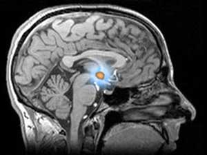 The hypothalamus is a tiny part of the brain but regulates the whole body’s metabolism through hormones