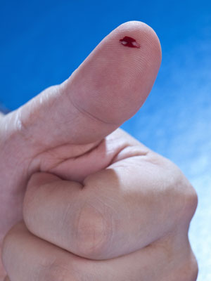 People with hemophilia have blood that doesn't clot properly. Genome editing restored normal blood clotting in mice with the hemophilia mutation.  
