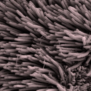 Cilia, tiny hairs protruding into the ventricles of the brain, wave in synchrony to pump around CSF.  This function is impaired in the HD brain, though it's not yet clear if this is related to the "trash disposal" problems observed in HD brains.  