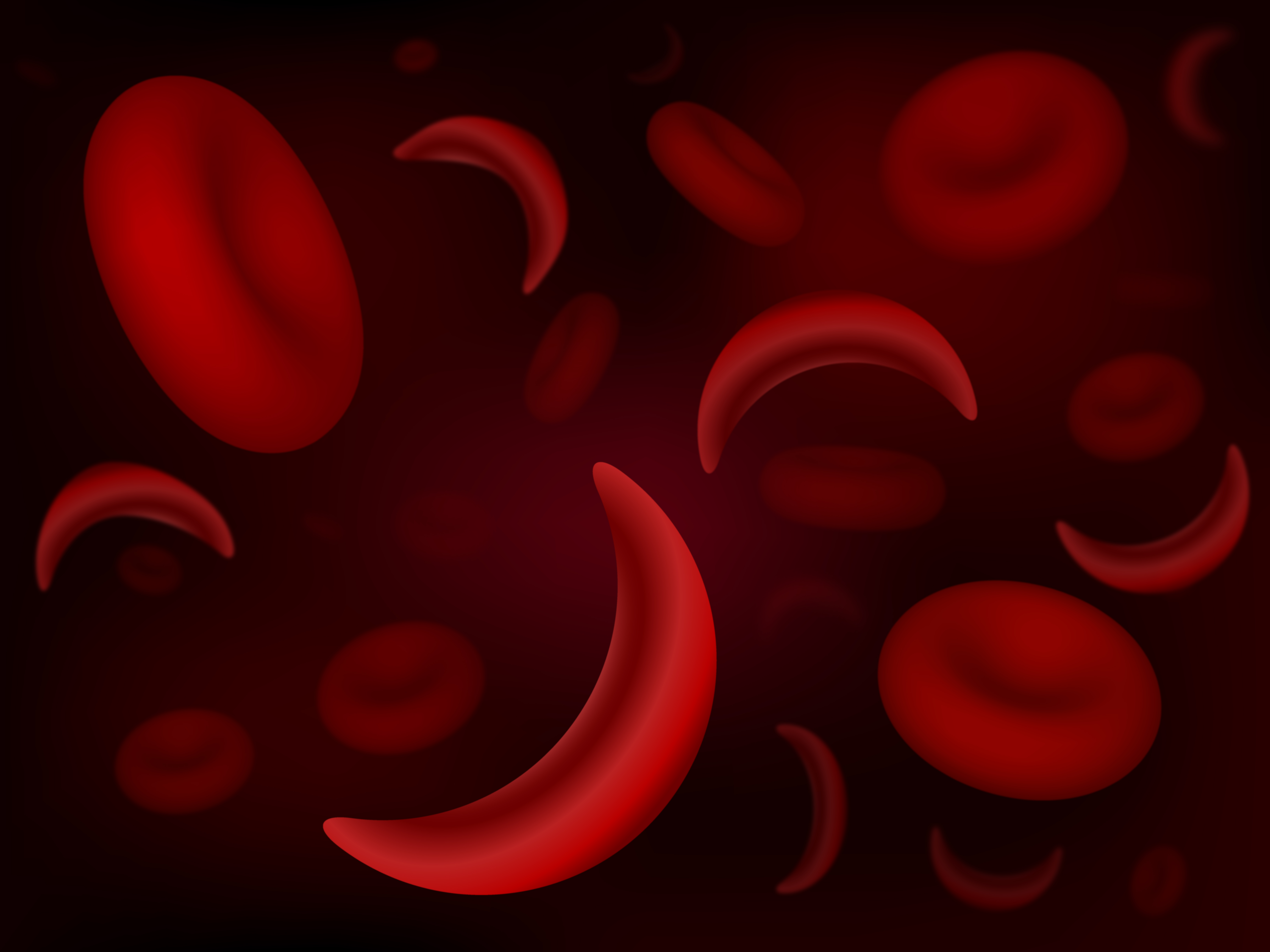 Sickle Cell Disease causes red blood cells to adopt a “C” or sickle-like shape. People with this disease lack a protein that gives the red blood cells a rigid shape that helps them carry oxygen throughout the body. Carrying less oxygen means that people with Sickle Cell Disease have fewer red blood cells and can experience clogged blood vessels and potentially stroke.  