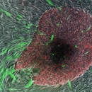 "Indukované" kmenové buňky představují významní pokrok