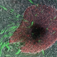 „Indukované pluripotentní kmenové buňky” rostoucí z kožních buněk (na obrázku zobrazené zeleně a červeně).  