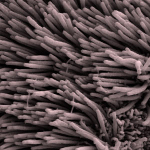 Řasinky jsou mrňavé vlasovité výčnělky na naších buňkách. Různé tagy způsobují, že huntingtin s nimi interaguje různými způsoby.  